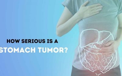how serious is a stomach tumor 400x250